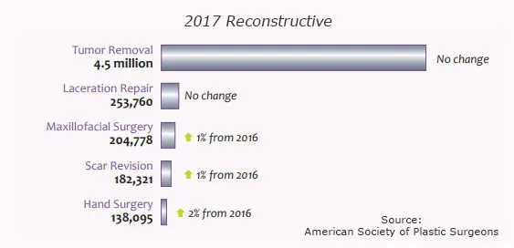 Top 5 Reconstructive Procedures 2017